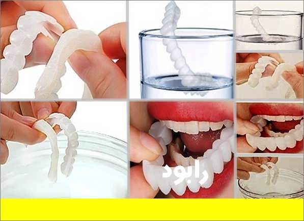 طرز استفاده از لمینت متحرک دندان