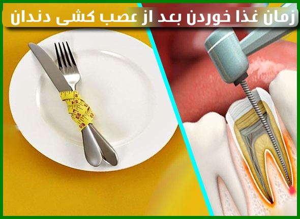 زمان غذا خوردن بعد از عصب کشی دندان :