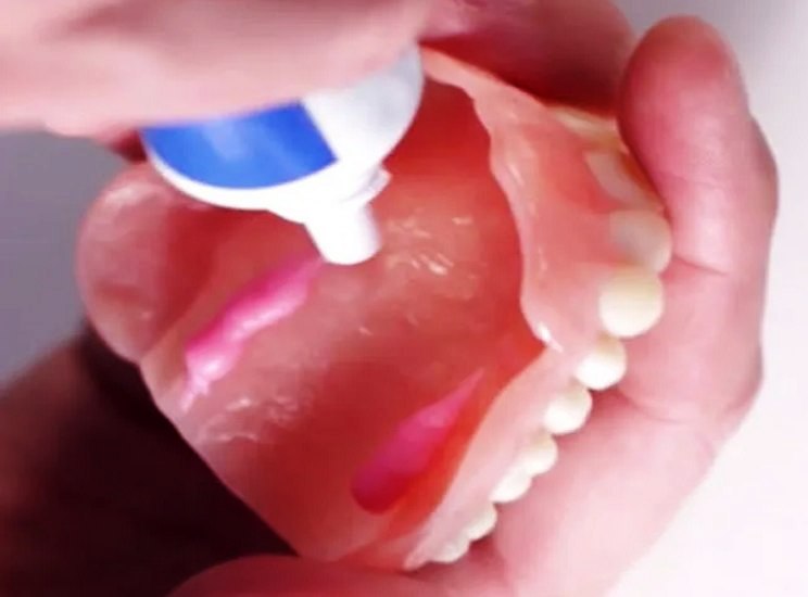 نحوه گرفتن لقی دندان مصنوعی با چسب مخصوص