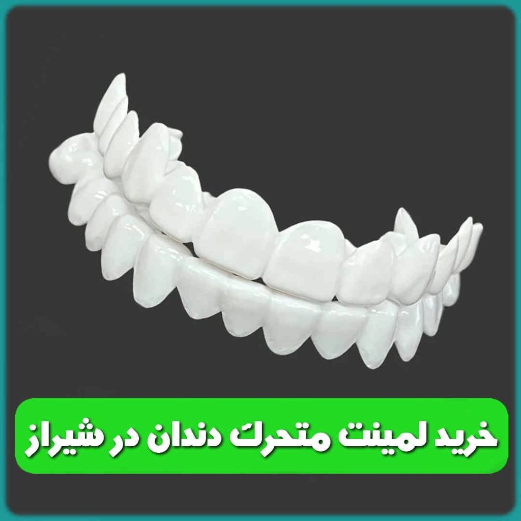 خرید لمینت متحرک دندان در شیراز