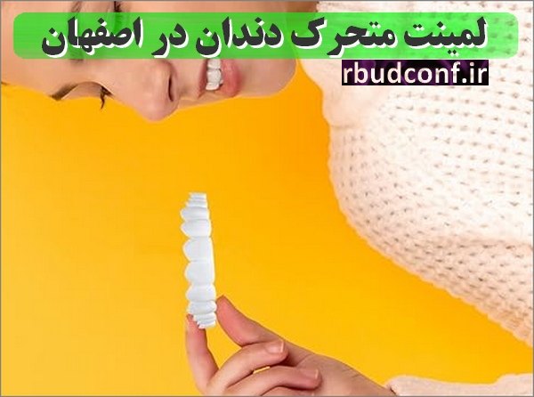 قیمت لمینت متحرک دندان در داروخانه اصفهان