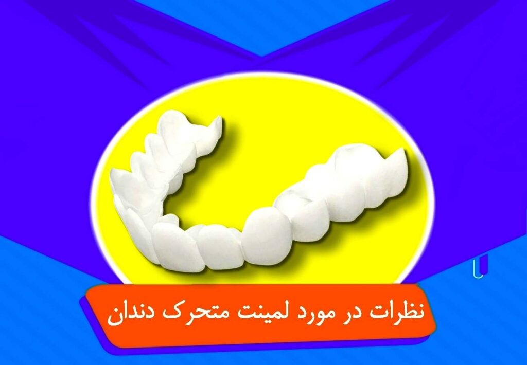 ظرات در مورد لمینت متحرک دندان اسنپ اسمایل